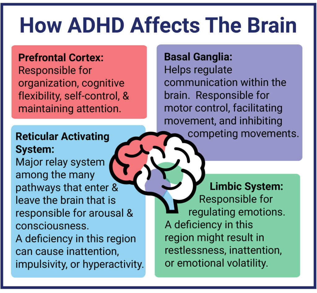 What Is ADHD An Overview Of The Causes And Signs Of ADHD Verdugo 