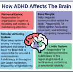 What Is ADHD An Overview Of The Causes And Signs Of ADHD Verdugo